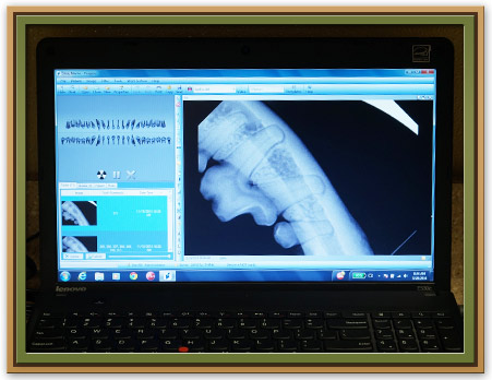 Digital Dental Radiology